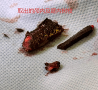 <b>同时正在风险防备之间连结隆重均衡</b>